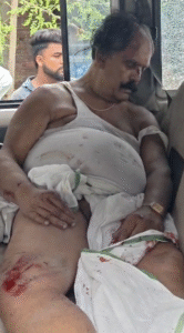 घटनास्थल पर दुलारचंद यादव के शरीर पर खून के निशान देते जा सकते हैं।