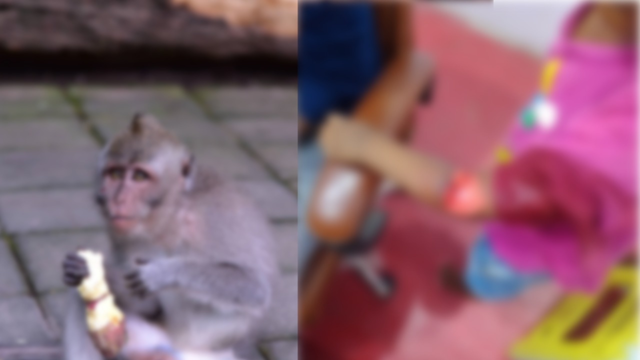 बच्ची के कोहनी पर गहरा घाव। (तस्वीर - टीम बोलते पन्ने)