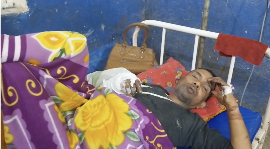 अस्पताल में इलाज के दौरान की तस्वीर।