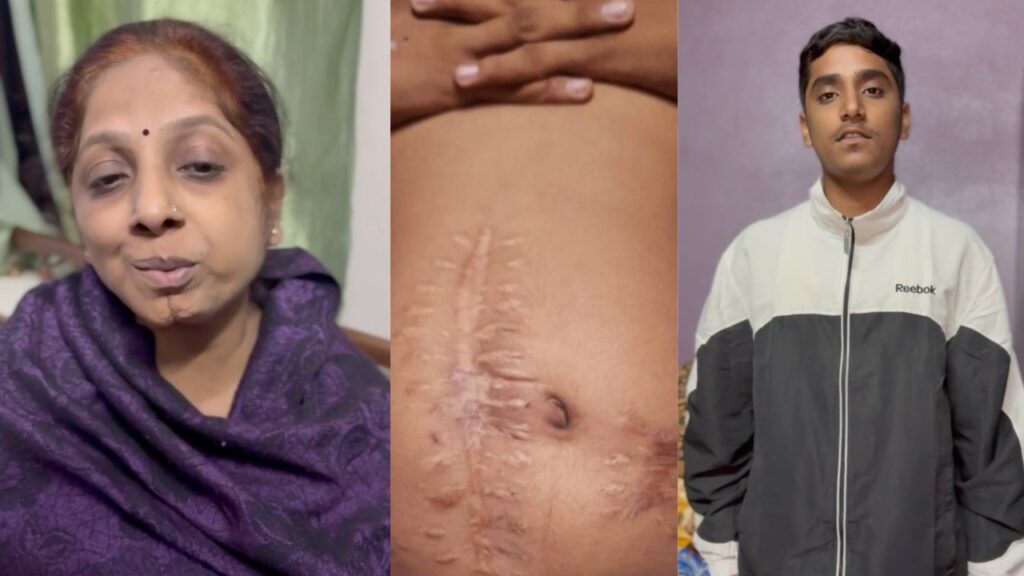 समर शेखर (दाएं) जब 11 साल के थे तो नामी सर्जन ने उनका गलत ऑपरेशन कर दिया, उनकी मां (बाएं) ने लंबी कानूनी लड़ाई लड़ी।