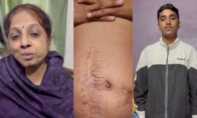 समर शेखर (दाएं) जब 11 साल के थे तो नामी सर्जन ने उनका गलत ऑपरेशन कर दिया, उनकी मां (बाएं) ने लंबी कानूनी लड़ाई लड़ी।