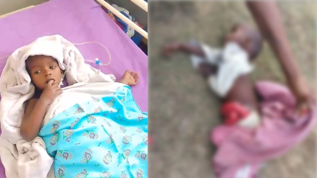 बच्चे के पेट से आंतें बाहर निकल आई थीं, वह नदी किनारे लावारिस मिला। पटना में हुए ऑपरेशन के बाद बच्चा स्वस्थ है।