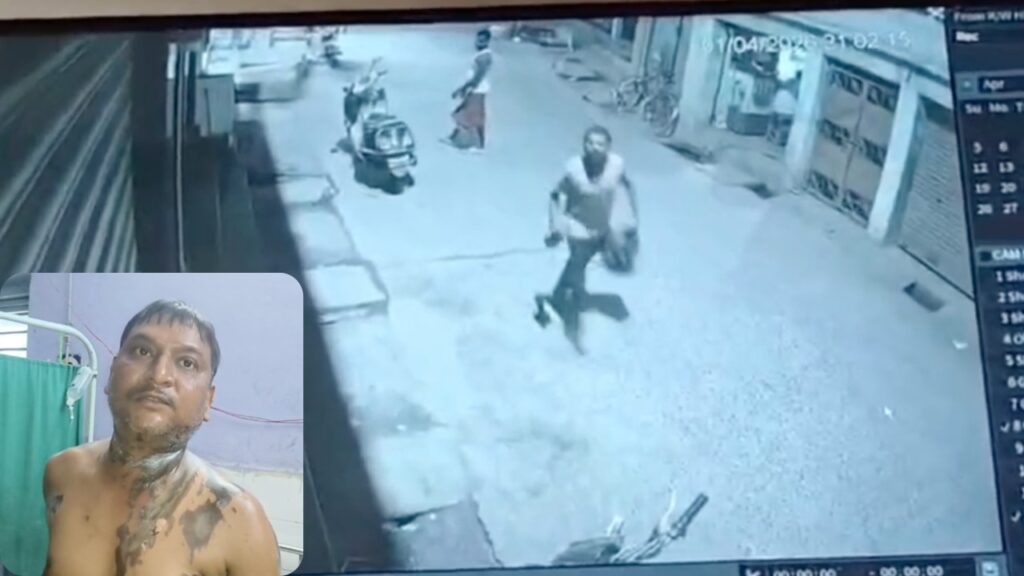 तेजाब फेंकने की घटना सीसीटीवी में कैद हुई, युवक का धड़ व पैर झुलस गए हैं (इनसेट)।
