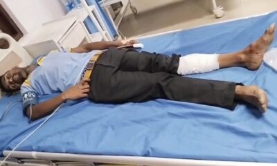 घायल हो गए नोजल मैन का इलाज चल रहा है।