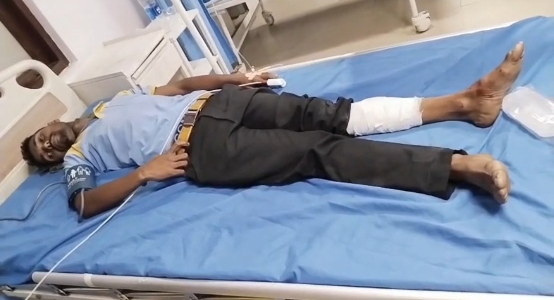 घायल हो गए नोजल मैन का इलाज चल रहा है।