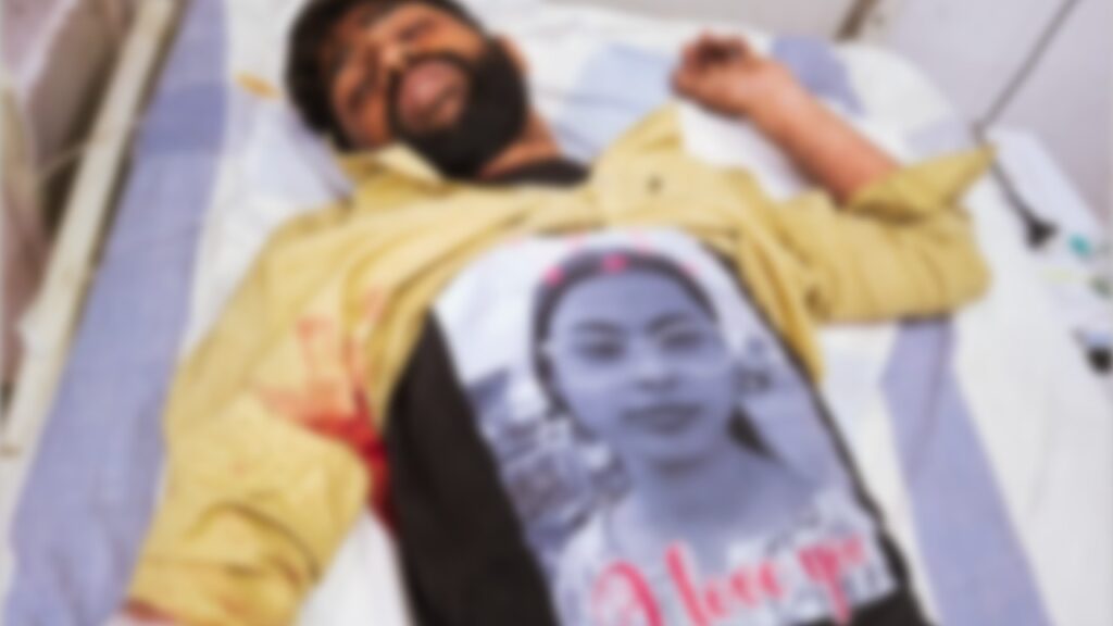 युवक को बेहतर इलाज के लिए रेफर किया गया है।