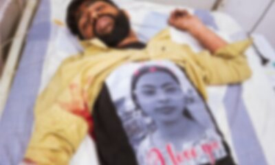 युवक को बेहतर इलाज के लिए रेफर किया गया है।